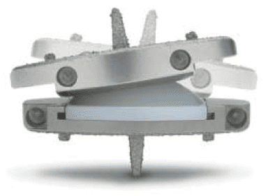 prodisc L rotation - design philosophy