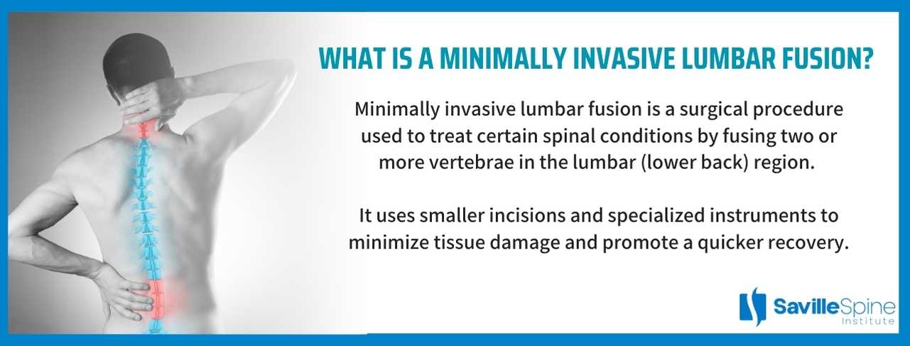 minimally invasive lumbar fusions