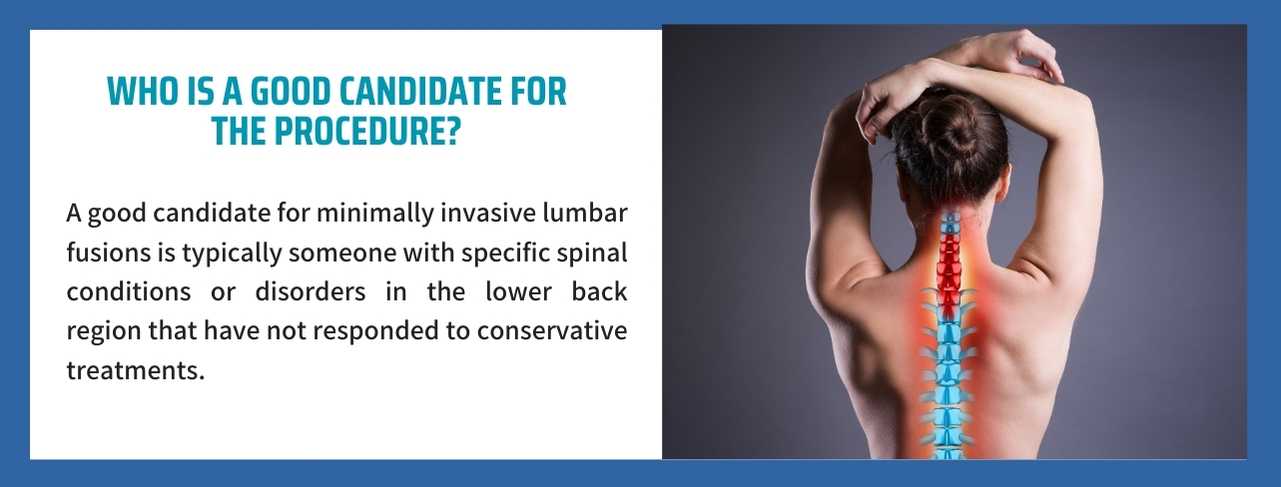 minimally invasive lumbar fusions