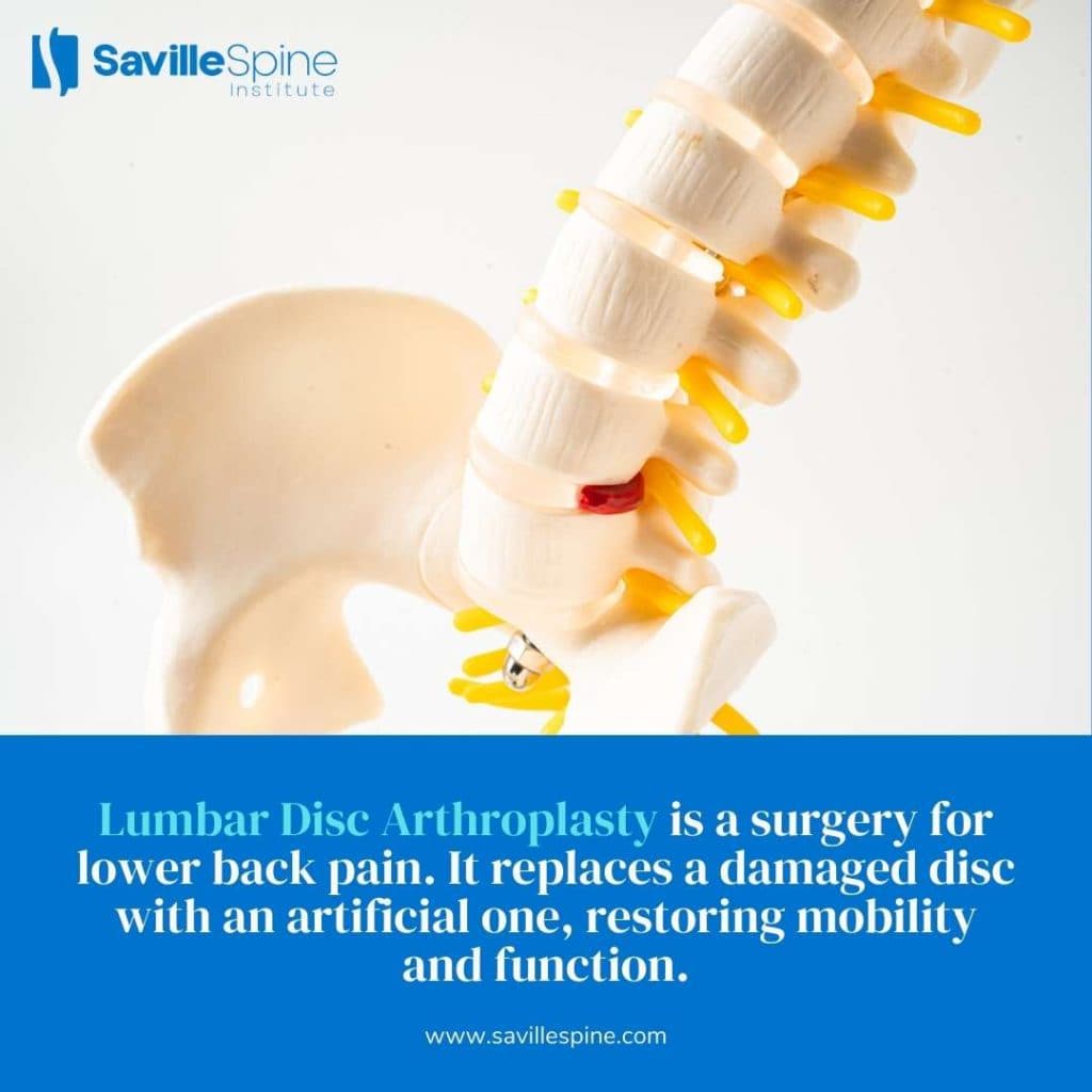 Recovery Timeline After Lumbar Disc Arthroplasty