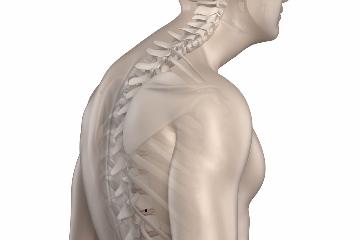 Understanding Minimally Invasive Surgery for Kyphosis