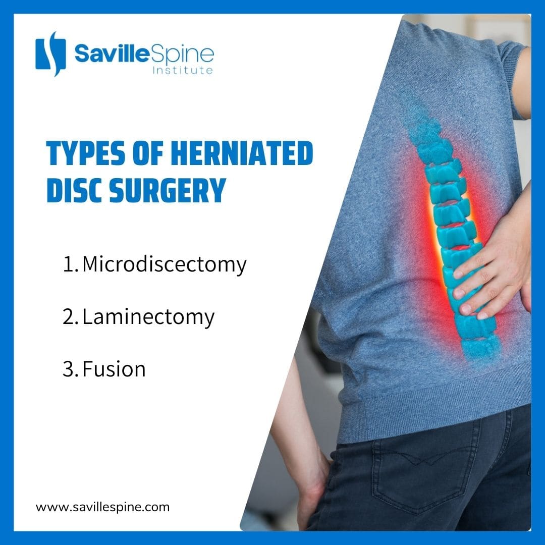 Can Herniated Disc Surgery Relieve Sciatica?