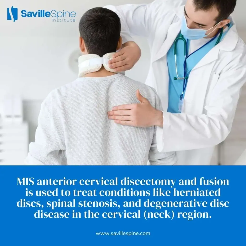 Minimally-Invasive-Anterior-Cervical-Discectomy-and-Fusion-ACDF-B-1