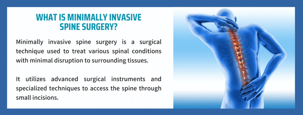 What To Expect After Minimally Invasive Spine Surgery?