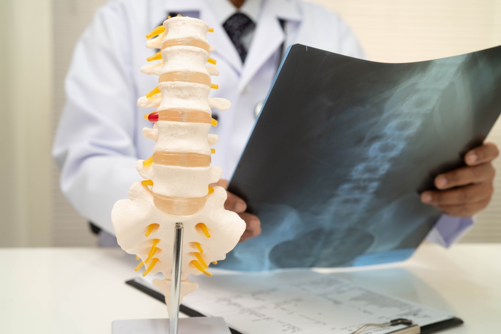 Spine specialist reviewing X-rays for lumbar disc replacement.